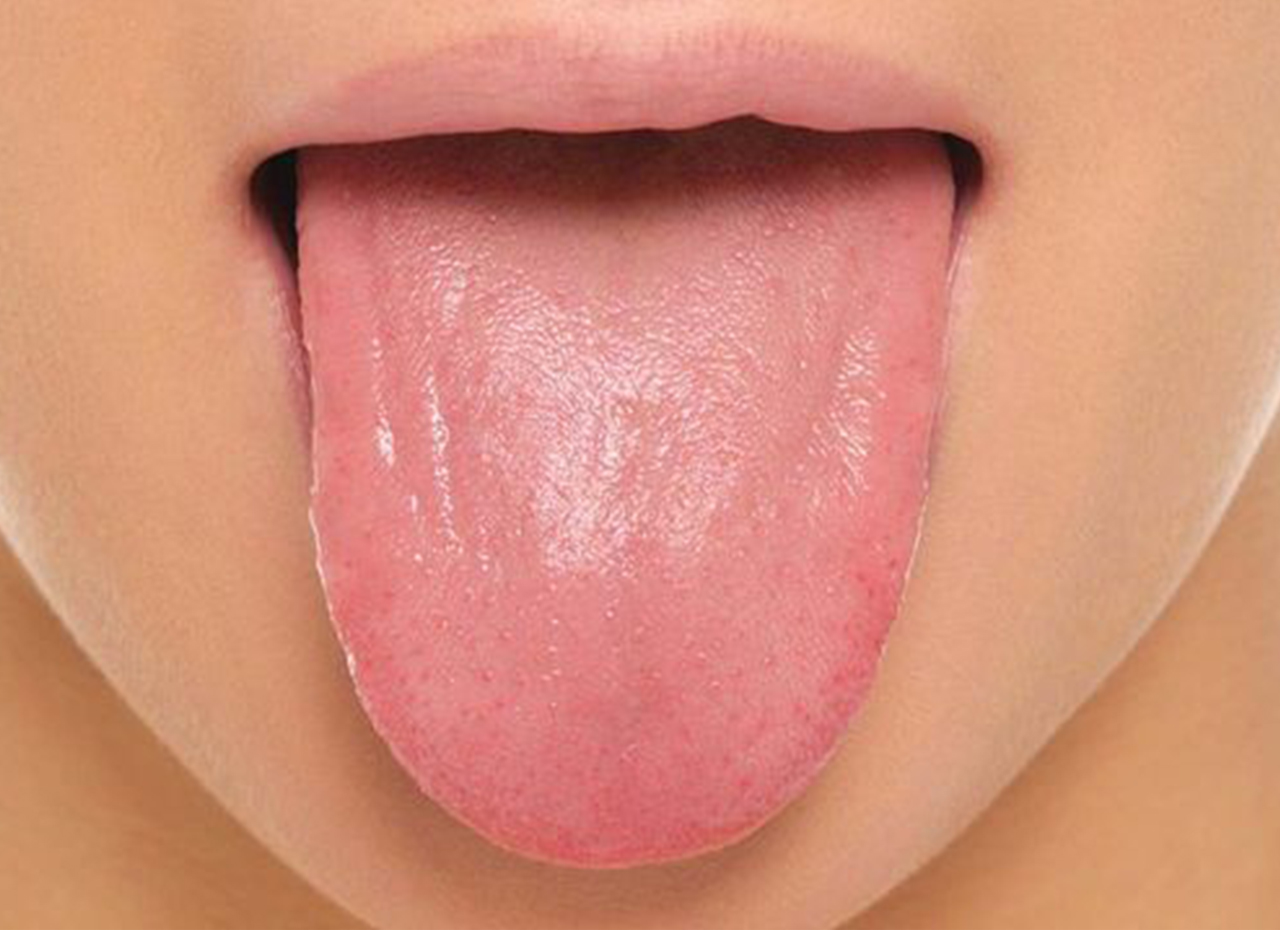 The Importance Of Cleaning Your Tongue Centre Dentaire Saint Lambert