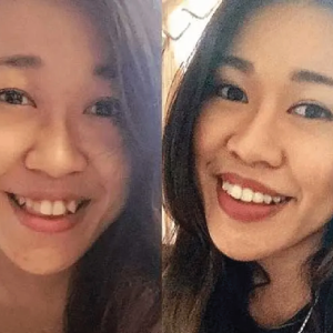 Invisalign Centre Dentaire Saint-Lambert Inc Dentistes St Lambert Dentist Dental Centre