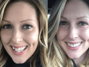 Invisalign Centre Dentaire Saint-Lambert Inc Dentistes St Lambert Dentist Dental Centre