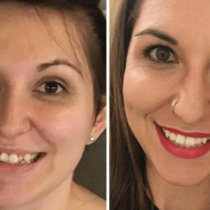 Invisalign Centre Dentaire Saint-Lambert Inc Dentistes St Lambert Dentist Dental Centre