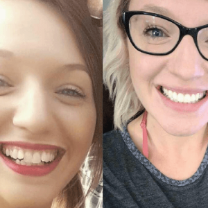 Invisalign Centre Dentaire Saint-Lambert Inc Dentistes St Lambert Dentist Dental Centre