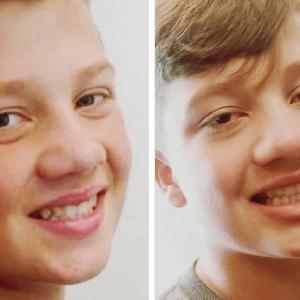 Invisalign Centre Dentaire Saint-Lambert Inc Dentistes St Lambert Dentist Dental Centre