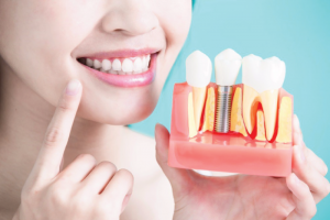 Our Services Centre Dentaire Saint-Lambert Inc Dentistes St Lambert Dentist Dental Centre